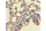 Immunohistochemistry of paraffin-embedded human lung tissue using CSB-PA005584LA01HU at dilution of 1:100