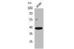 Western Blot analysis of A549 cells using CGR19 Polyclonal Antibody.