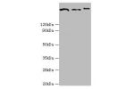All lanes:Clathrin heavy chain 2 antibody at 2ug/ml<br />
Lane 1:Jurkat whole cell lysate<br />
Lane 2:NIH3T3 whole cell lysate<br />
Lane 3:A431 whole cell lysate<br />
Secondary<br />
Goat polyclonal to rabbit at 1/10000 dilution<br />
Predicted band si