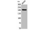 Western Blot analysis of AD293 cells using Macroglobulin a-2 Polyclonal Antibody.