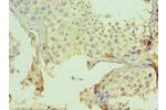 Immunohistochemistry of paraffin-embedded human testicle using CSB-PA005599ESR1HU at dilution 1:100