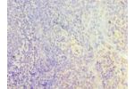 Immunohistochemistry of paraffin-embedded human tonsil using CSB-PA005599ESR2HU at dilution 1:100