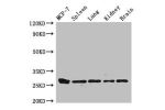 Western Blot<br />
Positive WB detected in:MCF-7 whole cell lysate,Mouse spleen tissue,Mouse lung tissue,Mouse kidney tissue,Mouse brain tissue<br />
All lanes:CMA1 antibody at 3ug/ml<br />
Secondary<br />
Goat polyclonal to rabbit IgG at 1/50000 dilution