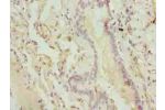Immunohistochemistry of paraffin-embedded human lung tissue using CSB-PA005603LA01HU at dilution of 1:100