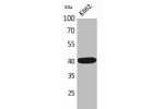 Western Blot analysis of K562 cells using Connexin-40 Polyclonal Antibody.