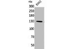 Western Blot analysis of K562 cells using Apaf-1 Polyclonal Antibody.