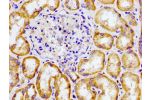 Immunohistochemistry of paraffin-embedded human kidney tissue using CSB-PA005614LA01HU at dilution of 1:100