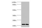 Western blot<br />
All lanes:CMPK1 antibody at 3.55ug/ml<br />
Lane 1:293T whole cell lysate<br />
Lane 2:Hela whole cell lysate<br />
Secondary<br />
Goat polyclonal to rabbit at 1/10000 dilution<br />
Predicted band size: 23,17 kDa<br />
Observed band s