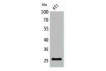 Western Blot analysis of 4T1 cells using CD81 Polyclonal Antibody.