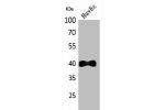 Western Blot analysis of HuvEc cells using IL-8R