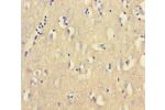 Immunohistochemistry of paraffin-embedded human brain tissue using CSB-PA005637HA01HU at dilution 1:100