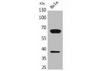 Western Blot analysis of HeLa cells using DNAM-1 Polyclonal Antibody.