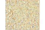 Immunohistochemistry of paraffin-embedded human liver tissue using CSB-PA005653LA01HU at dilution 1:100