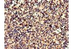 Immunohistochemistry of paraffin-embedded human spleen tissue using CSB-PA005679LA01HU at dilution of 1:100