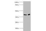 Western blot<br />
All lanes:CNTFR antibody at 2ug/ml+Hela whole cell lysate<br />
Secondary<br />
Goat polyclonal to rabbit at 1/10000 dilution<br />
Predicted band size: 41kDa<br />
Observed band size: 41kDa<br />