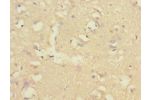 Immunohistochemistry of paraffin-embedded human brain tissue CSB-PA005692ESR1HU at dilution 1:100