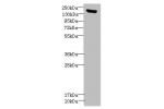 Western blot<br />
All lanes: CNTNAP1antibody IgG at 1.36ug/ml+ Mouse brain tissue<br />
Secondary<br />
Goat polyclonal to rabbit IgG at 1/10000 dilution<br />
Predicted band size: 156 kDa<br />
Observed band size: 156 kDa<br />