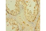Immunohistochemistry of paraffin-embedded human testis tissue using CSB-PA005692LA01HU at dilution 1:100