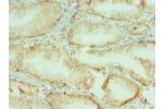Immunohistochemistry of paraffin-embedded human prostate using CSB-PA005715ESR1HU at dilution 1:100