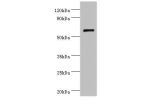 All lanes: Collagen alpha-1(X) chain antibody at 4ug/ml+K562 whole cell lysate<br />
Secondary<br />
Goat polyclonal to rabbit at 1/10000 dilution<br />
Predicted band size: 66kDa<br />
Observed band size: 66kDa<br />
