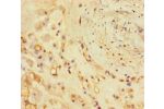 Immunohistochemistry of paraffin-embedded human placenta tissue using CSB-PA005716LA01HU at dilution of 1:100