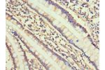 Immunohistochemistry of paraffin-embedded human small intestine using CSB-PA005739ESR1HU at dilution 1:100