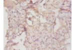 Immunohistochemistry of paraffin-embedded human placenta tissue using CSB-PA005743LA01HU at dilution 1:100