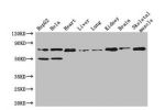 Western Blot<br />
Positive WB detected in:HepG2 whole cell lysate,Hela whole cell lysate,Mouse heart tissue,Mouse liver tissue,Mouse lung tissue,Mouse kidney tissue,Mouse brain tissue,Mouse skeletal muscle tissue<br />
All lanes: COL8A1 antibody at 3ug/m