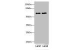 Western blot<br />
All lanes: