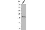 Western Blot analysis of K562 cells using FGF-8 Polyclonal Antibody.