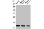 Western Blot analysis of HepG2, mouse thymus, mouse skeletal muscle cells using Eotaxin Polyclonal Antibody.