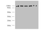 Western blot<br />
All lanes: COPB1 antibody at 1ug/ml<br />
Lane 1 : Hela whole cell lysate<br />
Lane 2 : Jurkat whole cell lysate<br />
Lane 3 : NIH/3T3 whole cell lysate<br />
Lane 4 : Mouse liver tissue<br />
Lane 5 : A549 whole cell lysate<br />
Sec