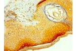 Immunohistochemistry of paraffin-embedded human skin using CSB-PA005789ESR2HU at dilution 1:100