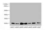 Western blot<br />
All lanes: COPZ1 antibody at 1ug/ml<br />
Lane 1 : Hela whole cell lysate<br />
Lane 2 : NIH/3T3 whole cell lysate<br />
Lane 3 : RAW 264.7 whole cell lysate<br />
Lane 4 : Jurkat whole cell lysate<br />
Lane 5 : Mouse liver tissue<br /