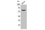 Western Blot analysis of HeLa cells using FMO3 Polyclonal Antibody.