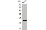 Western Blot analysis of HeLa cells using CD3-d Polyclonal Antibody.