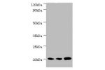 Western blot<br />
All lanes:COX4I1 antibody at 5ug/ml<br />
Lane 1:MCF-7 whole cell lysate<br />
Lane 2:A549 whole cell lysate<br />
Lane 3:HepG2 whole cell lysate<br />
Secondary<br />
Goat polyclonal to rabbit at 1/10000 dilution<br />
Predicted band s