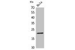 Western Blot analysis of HeLa cells using CD3-e Polyclonal Antibody.