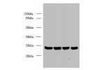 Western blot<br />
All lanes: EMC8 antibody at 0.8ug/ml<br />
Lane 1 : A549 whole cell lysate<br />
Lane 2 : Human placenta tissue<br />
Lane 3 : Hela whole cell lysate<br />
Lane 4 : HT29 whole cell lysate<br />
Secondary<br />
Goat polyclonal to Rabbit 