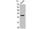 Western Blot analysis of HepG2 cells using CD69 Polyclonal Antibody.