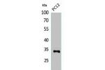 Western Blot analysis of PC12 cells using CD74 Polyclonal Antibody.