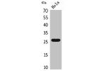 Western Blot analysis of HeLa cells using DCL-1 Polyclonal Antibody.
