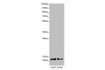 Western blot<br />
All lanes:COX7A2L antibody at 2.08 ug/ml<br />
Lane 1 : A549 whole cell lysate<br />
Lane 2 : HepG-2 whole cell lysate<br />
Secondary<br />
Goat polyclonal to rabbit IgG at 1/10000 dilution<br />
Predicted band size: 13 kDa<br />
Obser