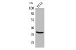 Western Blot analysis of PC12 cells using BST-1 Polyclonal Antibody.