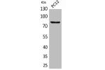 Western Blot analysis of PC12 cells using CD239 Polyclonal Antibody.