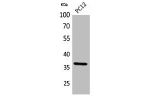 Western Blot analysis of PC12 cells using JAM-A Polyclonal Antibody.