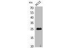 Western Blot analysis of PC12 cells using CMTM5 Polyclonal Antibody.