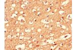 Immunohistochemistry of paraffin-embedded human brain tissue using CSB-PA005893LA01HU at dilution of 1:100