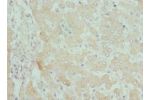 Immunohistochemistry of paraffin-embedded human liver tissue using CSB-PA005898ESR1HU at dilution 1:100