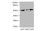 Western blot<br />
All lanes: CPN1 antibody at 6.19ug/ml<br />
Lane 1 : Mouse liver tissue<br />
Lane 2 : MCF7 whole cell lysate<br />
Lane 3 : HepG-2 whole cell lysate<br />
 Goat polyclonal to Rabbit IgG at 1/10000 dilution<br />
Predicted band size: 52